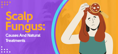 Scalp Fungus: Causes And Natural Treatments