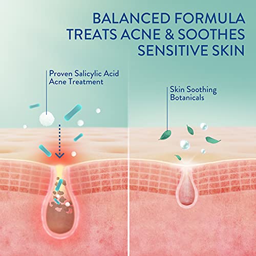 Cetaphil Acne Face Wash