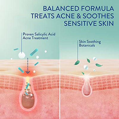 Cetaphil Acne Face Wash